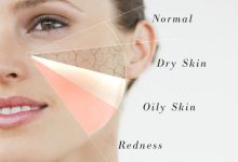 كيف أعرف نوع بشرتي