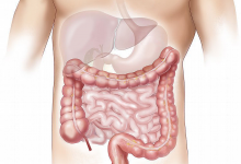 القولون العصبي