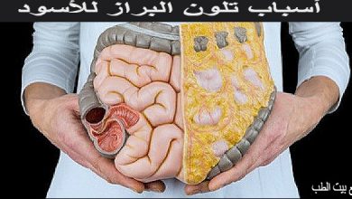 اسباب البراز الاسود